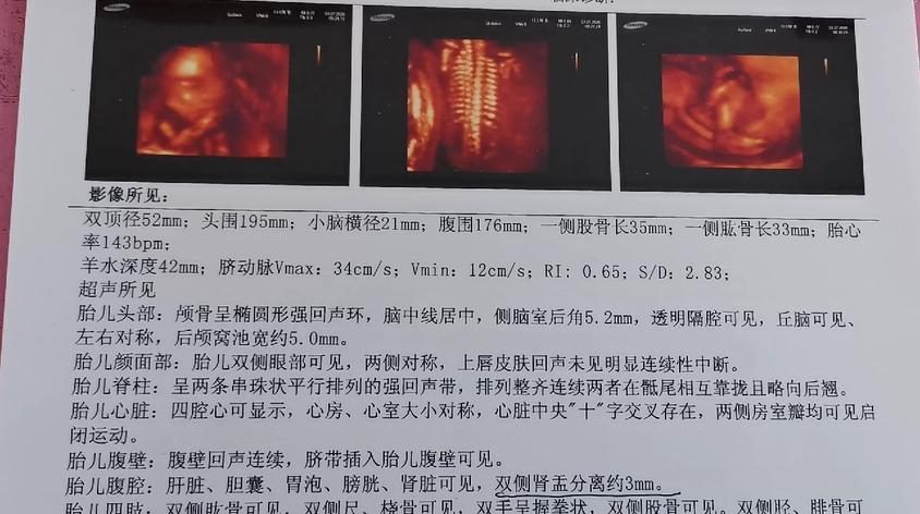 24周男孩四维彩超图片视频在线观看 - 西瓜视频