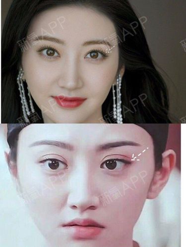 双眼皮对景甜的美貌程度影响有多大
