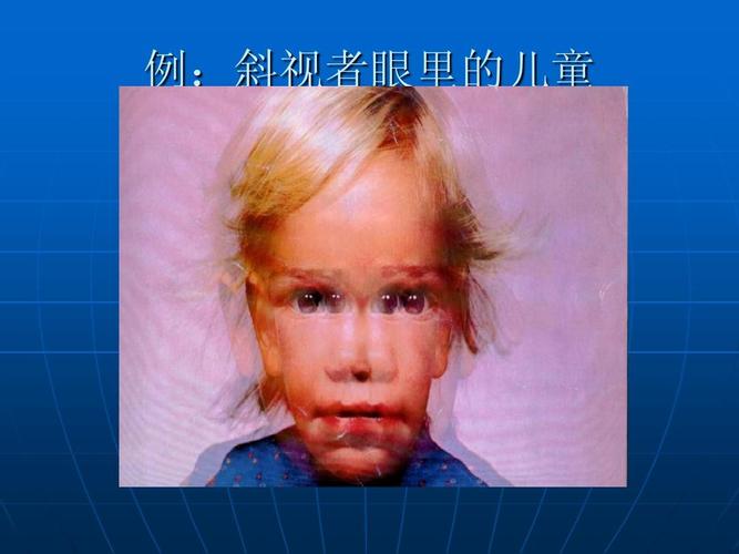 视觉障碍学生的融合教育ppt