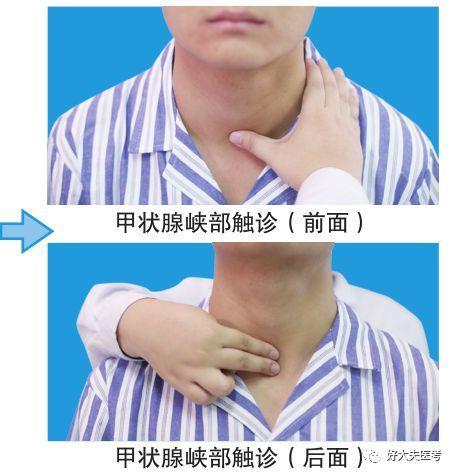 [ 检查方法 ]二,甲状腺触诊观察甲状腺大小,形态及对称性.
