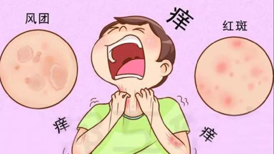 宝宝出疹误当普通过敏险致命荨麻疹不寻常熟记几大特征