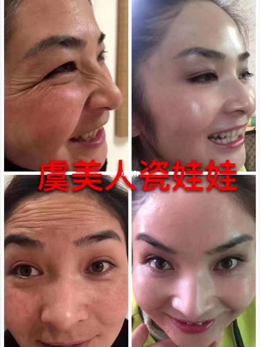 虞美人【瓷娃娃】10大奇迹92 92亮:温和亮泽如瓷般灵动闪现_毛孔