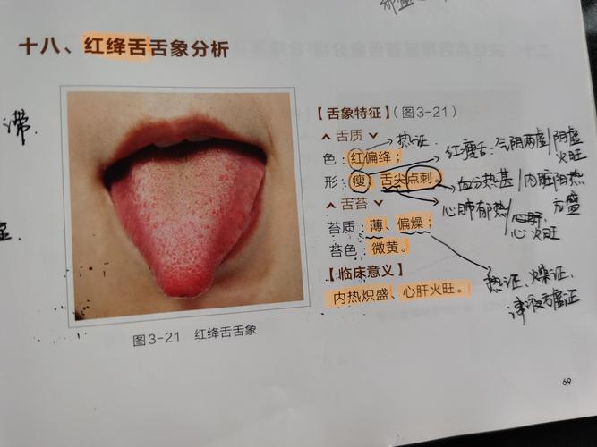 红绛舌舌象分析