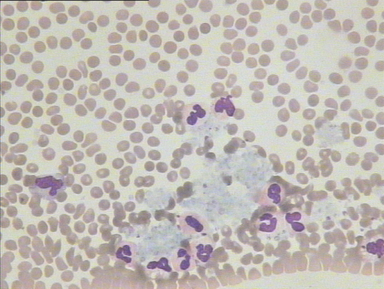 "隐匿"的血细胞