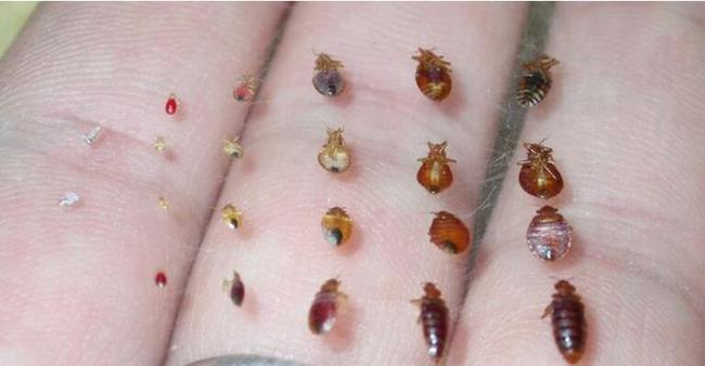 带你了解枕边的"吸血怪":床虱