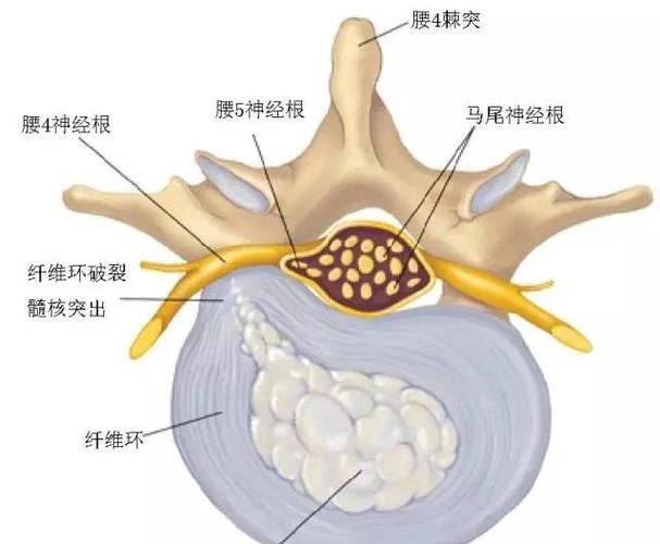 其它 脊柱解剖的基本要点 写美篇4 侧隐窝的毗邻 前壁:是椎体和纤维环