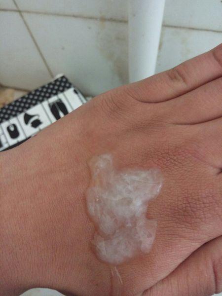 这样的精液正常吗?