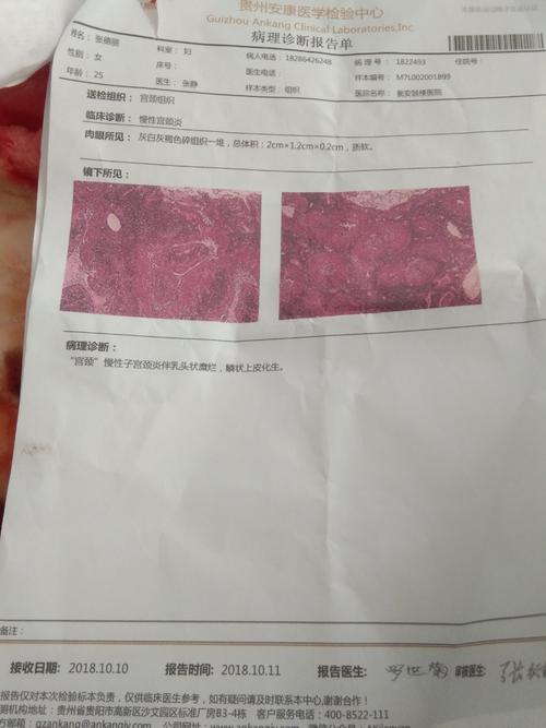 有没有宝妈像我一样的,这样的慢性宫颈炎,白带常规检查出来的