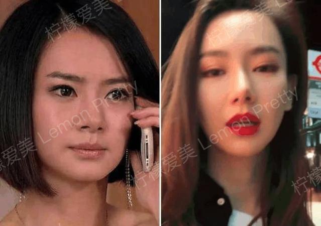 戚薇大方回应大学时割过双眼皮,看回以前的照片,你们觉得呢?