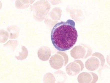 医学教育网 临床医学检验职称 血液检验 > 正文  红系包括原始红细胞