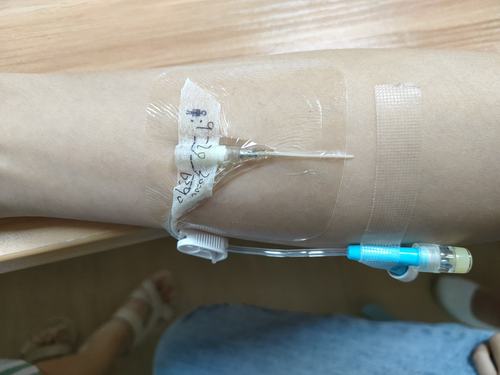 写美篇静脉留置针是临床输液治疗的常用工具,留置针的规范固定是静疗