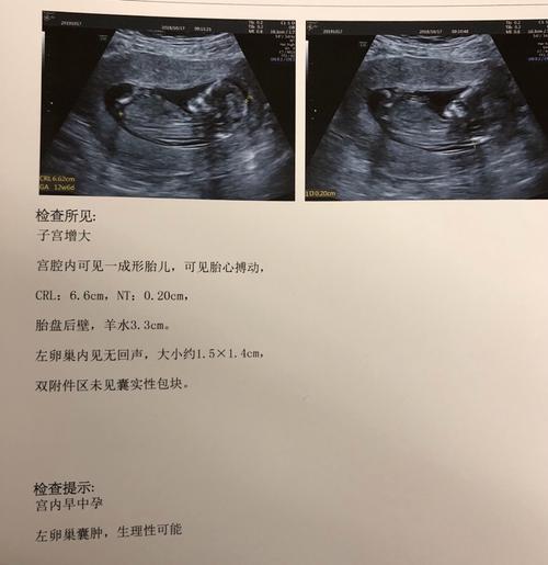 老一辈思想可谓是顽固啊,只盼生男孩,觉得女孩早晚一天都是别人家的