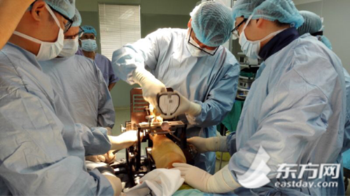 图片说明:瑞金医院足踝外科团队进行inbone全踝关节置换手术操作