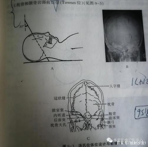 头颅正中面对台面中线,并与之垂直,下颌内收,听眦线与台面垂直,ip板上