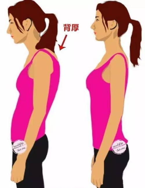 2,含胸驼背会造成侧面看起来肩膀厚实
