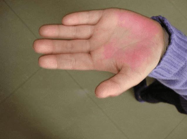 小学老师为处罚学生用戒尺打手心,被停课反省,到底是对是错