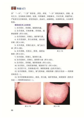 舌诊快速入门(第2版)