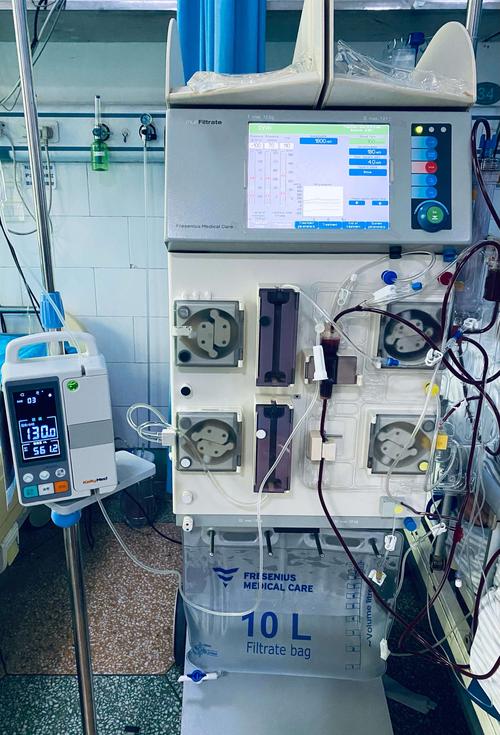 其它 血液透析和灌流在中毒中的应用 写美篇 (三)连续性血液滤过:尤其