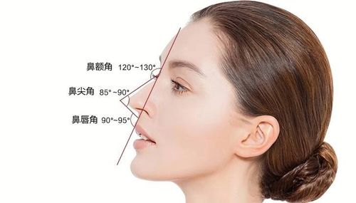 硅胶假体鼻背 自体耳软骨垫鼻尖能改善鼻子吗?-后的雪