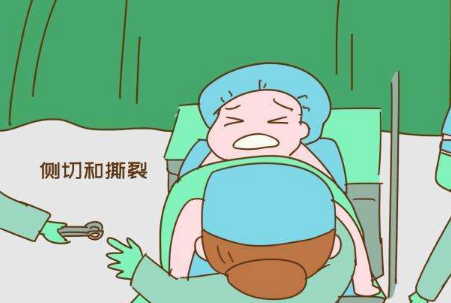 顺产时,侧切和撕裂哪个更可怕?两者有什么区别?