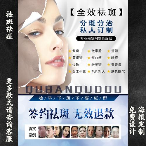 美容院祛斑祛痘海报广告宣传画图片微整专业去斑去痘挂图墙壁贴画