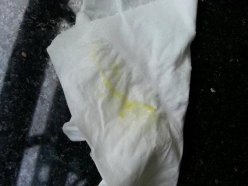 问:今天宝宝突然吐奶吐出黄色黏物状的东西,是什么啊?求专家解答,如图