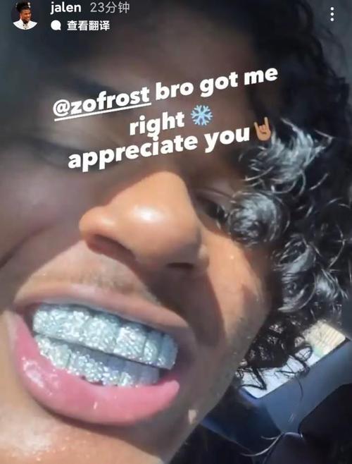 火箭榜眼晒钻石牙套引热议,球迷调侃:第一笔花