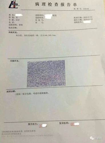 25岁姑娘查出胃癌!这些情况,胃肠镜检查必须要做