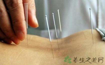针灸治疗腰间盘突出的效果(2)