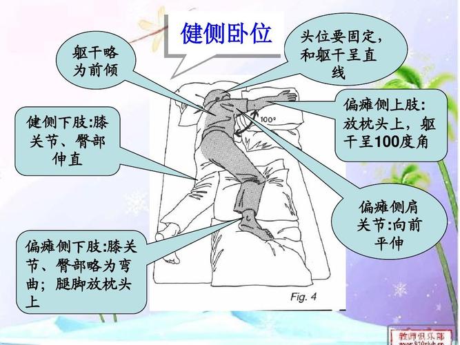 幼儿教育 育儿理论经验 脑梗塞教学查房ppt  躯干略 为前倾 健侧卧位