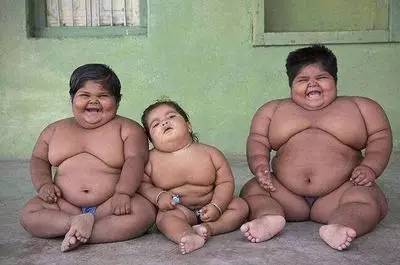 2,腹部膨隆下垂,严重肥胖者胸腹,臀部及大腿皮肤会出现白纹或紫纹; 3