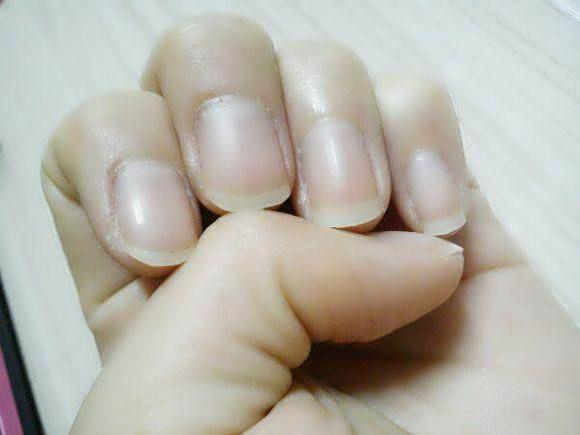 指甲上的月牙越多,身体越好吗?很多人都想错了,不妨了解一下吧