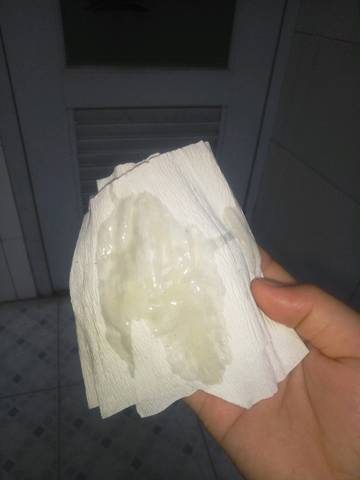 大家好,帮我看看这是羊水破了吗,早上偶尔来一股