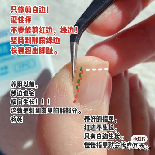 想知道除了拔甲以外有别的什么办法,例如软化指甲的药水或什么?