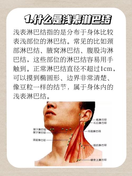 枕后淋巴结|宝宝脖颈黄豆粒大小肿物是什么_过敏_发烧