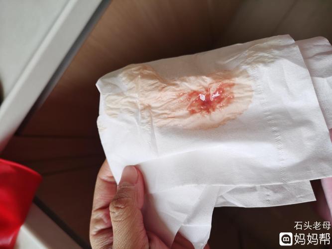 孕30天开始褐色分泌物没停到44天去b超