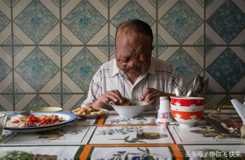 核辐射后惨象触目惊心