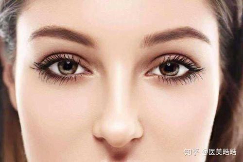 如何寻找适合自己的双眼皮?