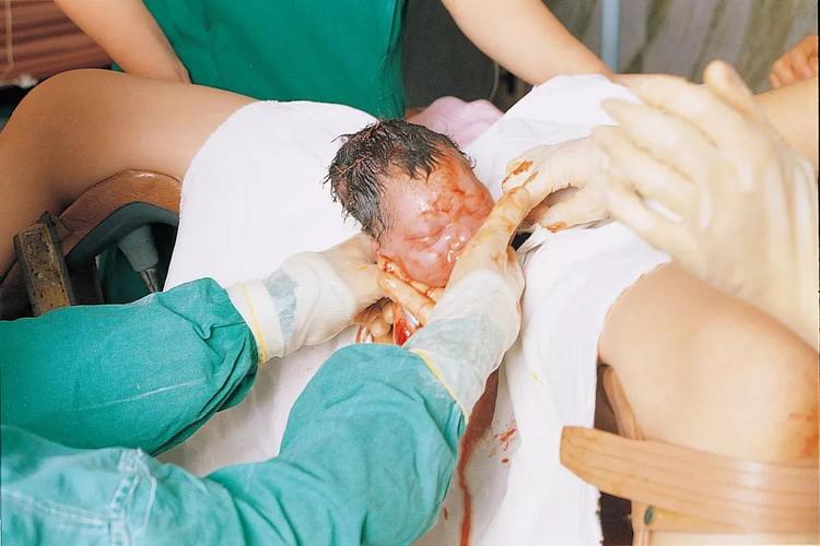 胆小勿看,实拍孕妇顺产惊心全过程,为全天下的妈妈点赞