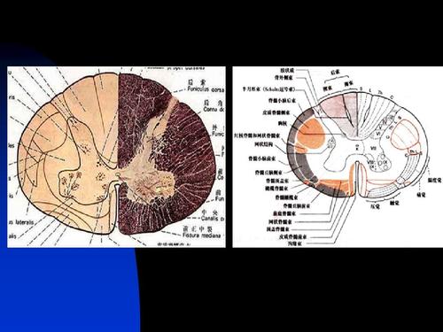 脊髓疾病ppt