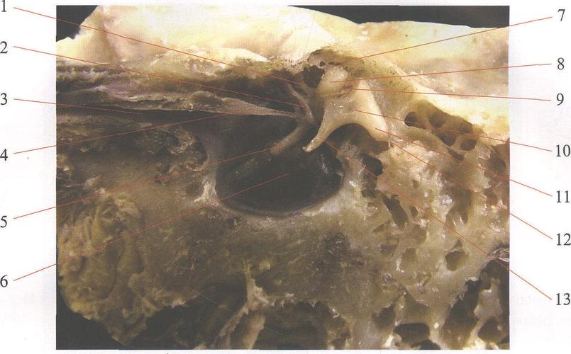 鼓索chorda tympani 3 咽鼓管pharyngotympanictube 4 鼓膜张肌tensor