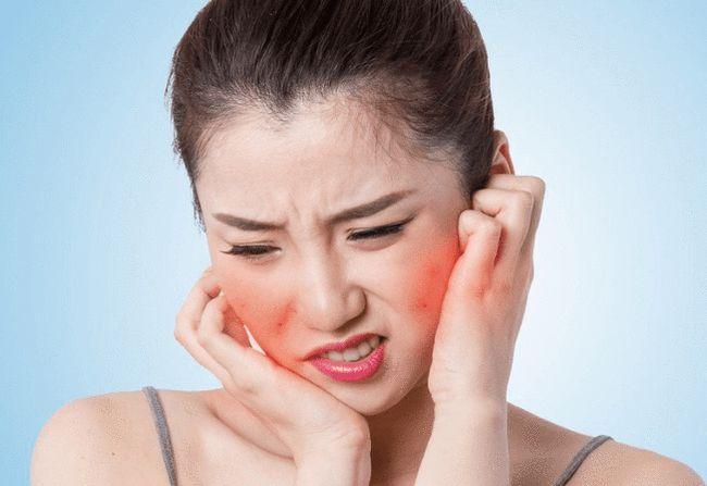 敏感肌是一种问题性肌肤的定义