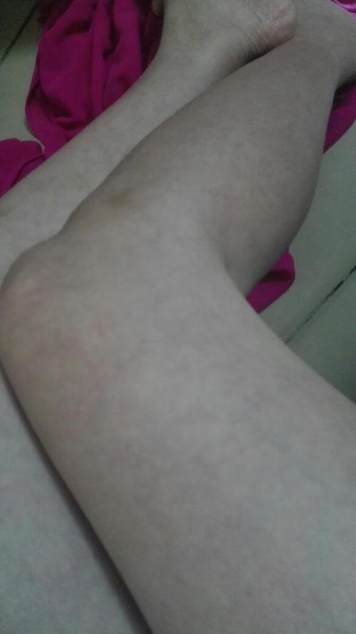 大家帮帮我看下,这皮肤怎么回事,不管冬天还是夏天,这皮肤都是黯黯的