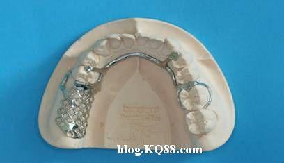 摘局部义齿设计图