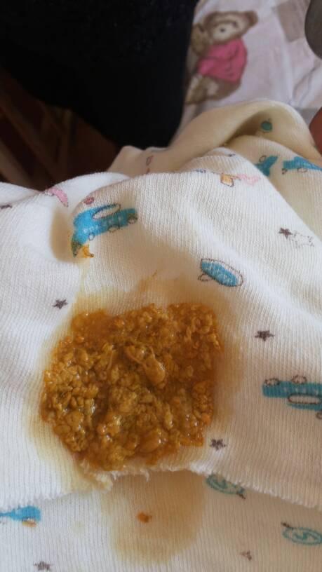 这两天每次拉粑粑都哭.这么大的宝宝每天