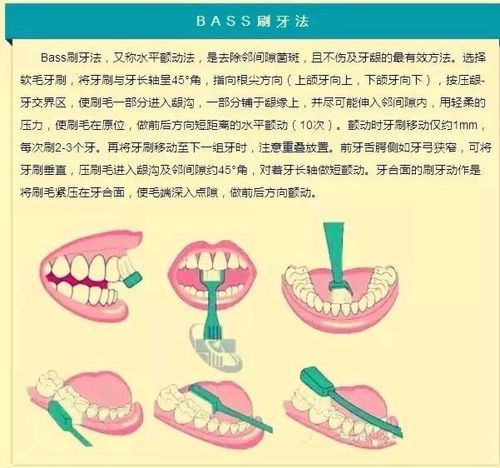 牙医:你们这不是在刷牙,而是"锯牙"!