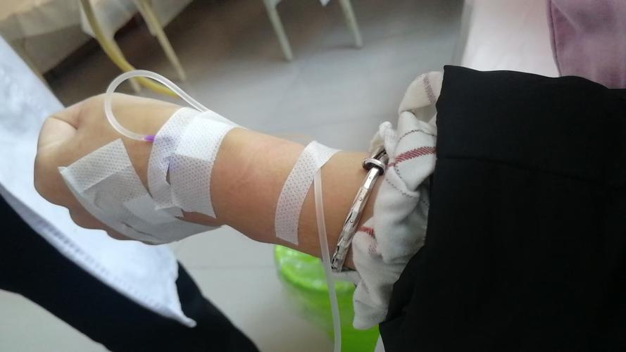 手上血管细输液扎针困难是一种什么体验?