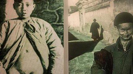 深度解析太监净身过程