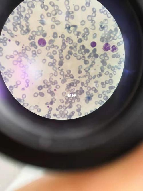 显微镜下的白细胞全家福_全家福_vlog_打工人的日常vlog_医疗健康