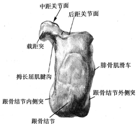 一种是腓肠肌强烈收缩导致的跟骨结节撕脱骨折,另一种是跟骰关节压缩